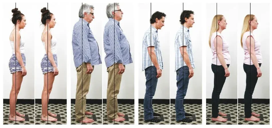 Before and after posture photos following an ABC™ adjustment