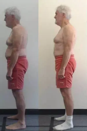 Melbourne City Chiropractic - Advanced BioStructural Correction™ (ABC™) - Our Results