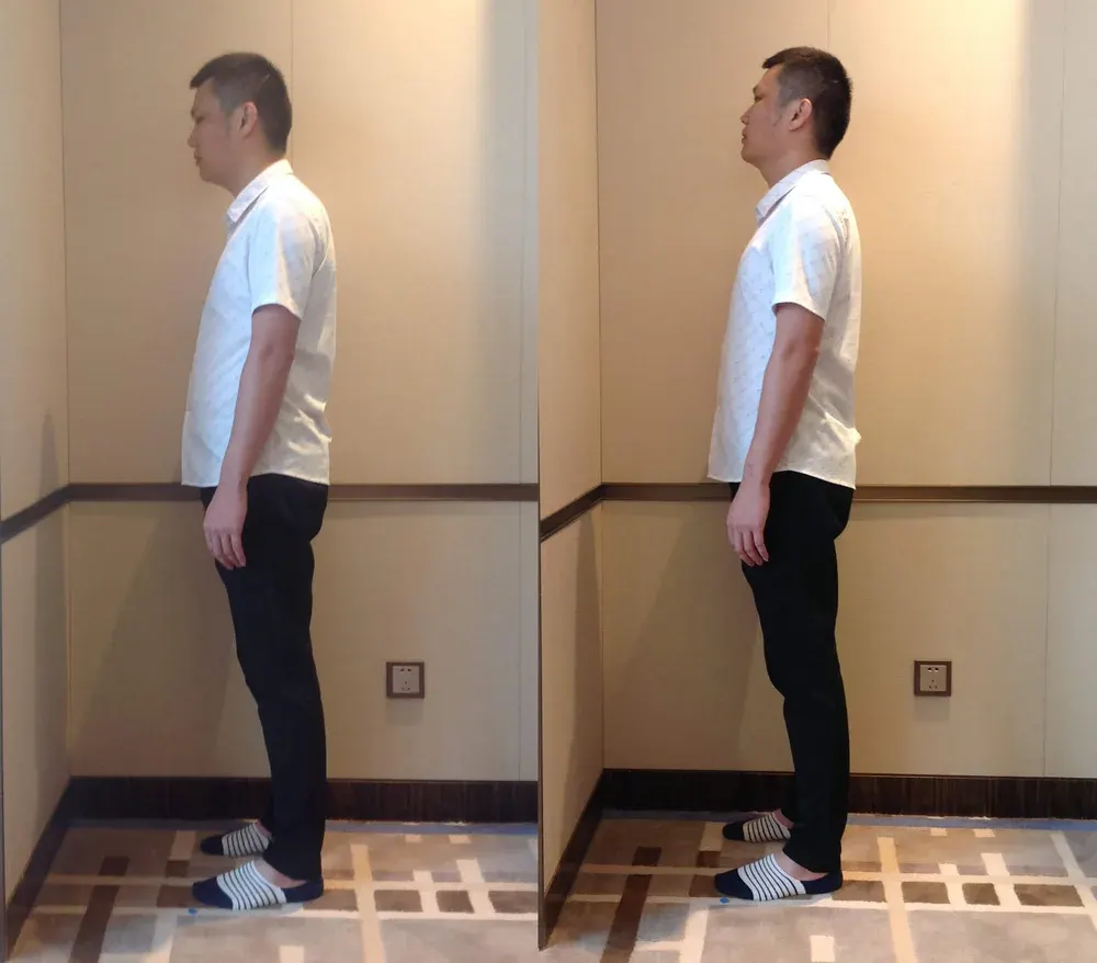 Melbourne City Chiropractic - Advanced BioStructural Correction™ (ABC™) - Our Results