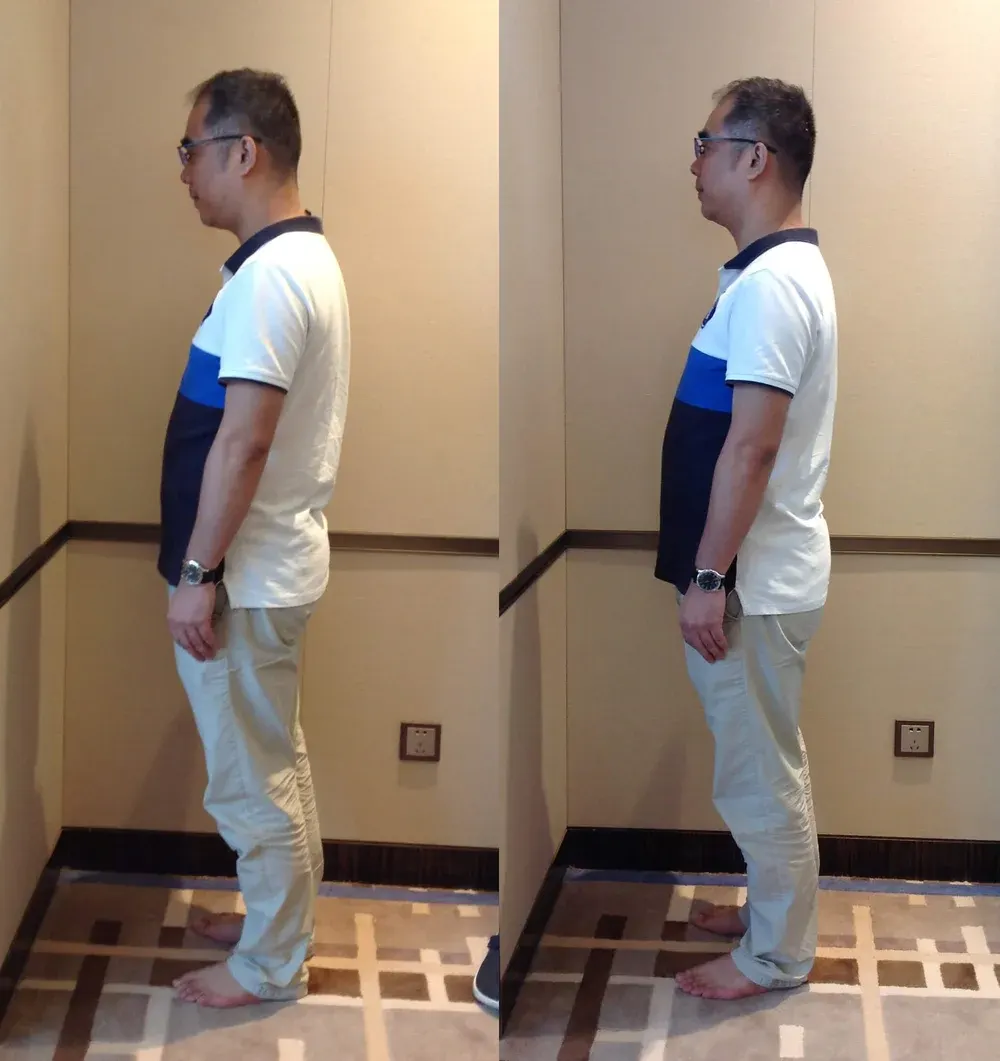 Melbourne City Chiropractic - Advanced BioStructural Correction™ (ABC™) - Our Results