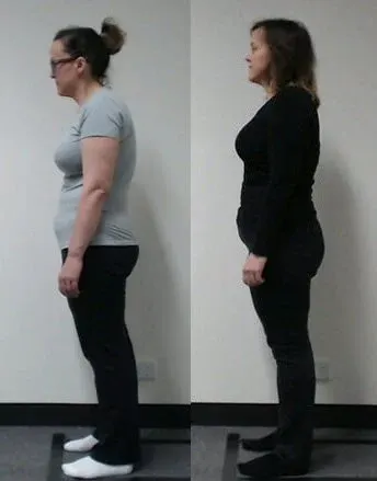 Melbourne City Chiropractic - Advanced BioStructural Correction™ (ABC™) - Our Results