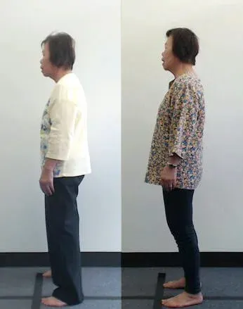 Melbourne City Chiropractic - Advanced BioStructural Correction™ (ABC™) - Our Results