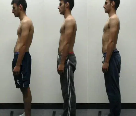 Melbourne City Chiropractic - Advanced BioStructural Correction™ (ABC™) - Our Results