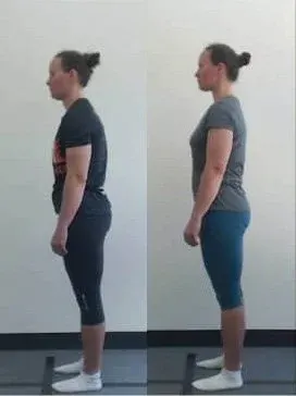 Melbourne City Chiropractic - Advanced BioStructural Correction™ (ABC™) - Our Results