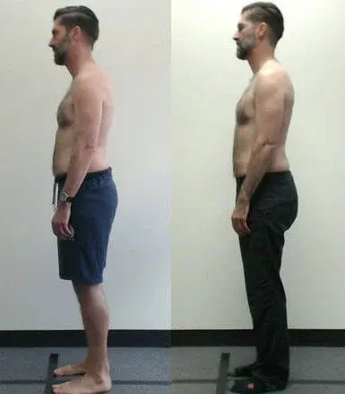 Melbourne City Chiropractic - Advanced BioStructural Correction™ (ABC™) - Our Results
